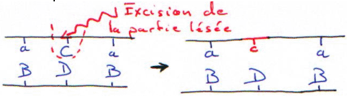 Réparation et excision partie lésée