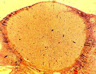 pourquoi la nidation échoue