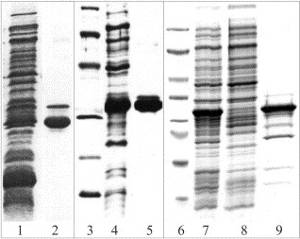 Chromatographie et protéine SARC