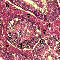 Coupe de testicule et cellule de Sertoli (n°7)