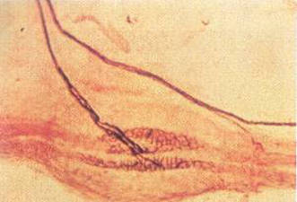 Photo en coupe d'un fuseau neuromusculaire observé au microscope optique